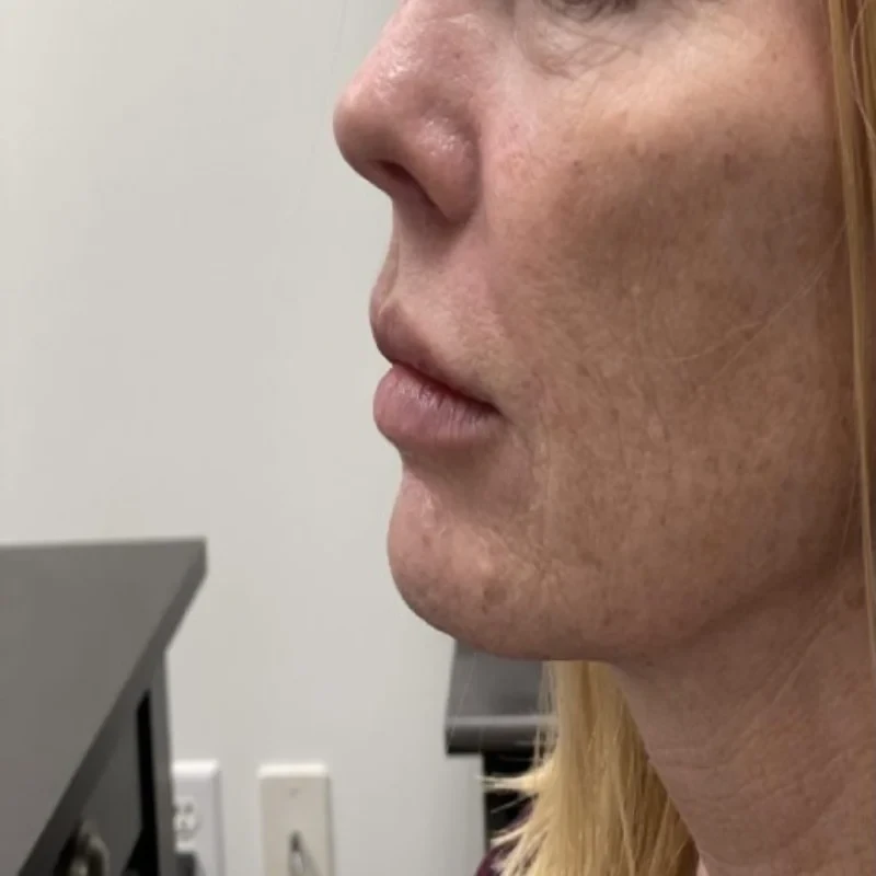A result from Integracare Medical care and Aesthetics