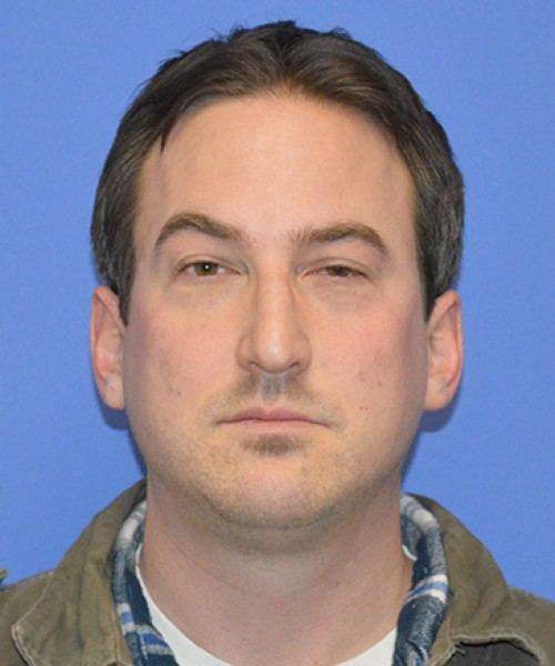 Blepharoplasty before photo
