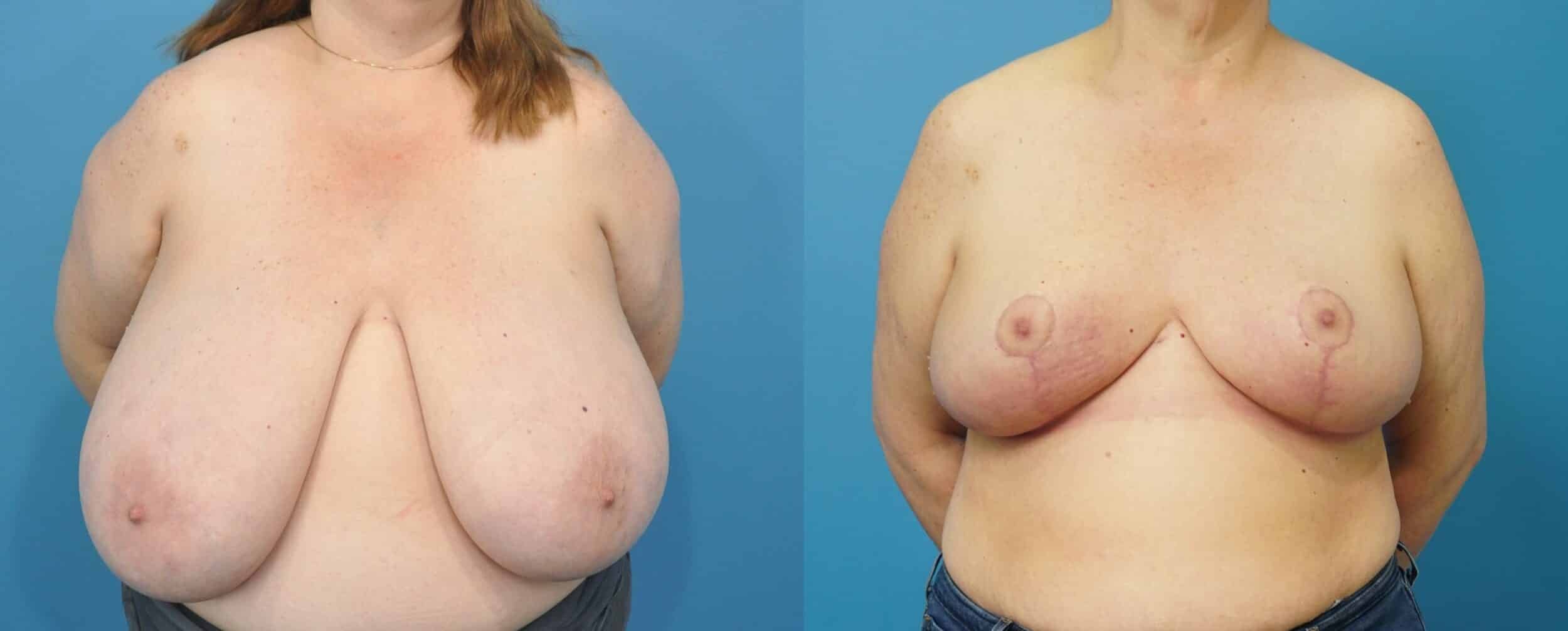 A result from Mark Sisco, MD