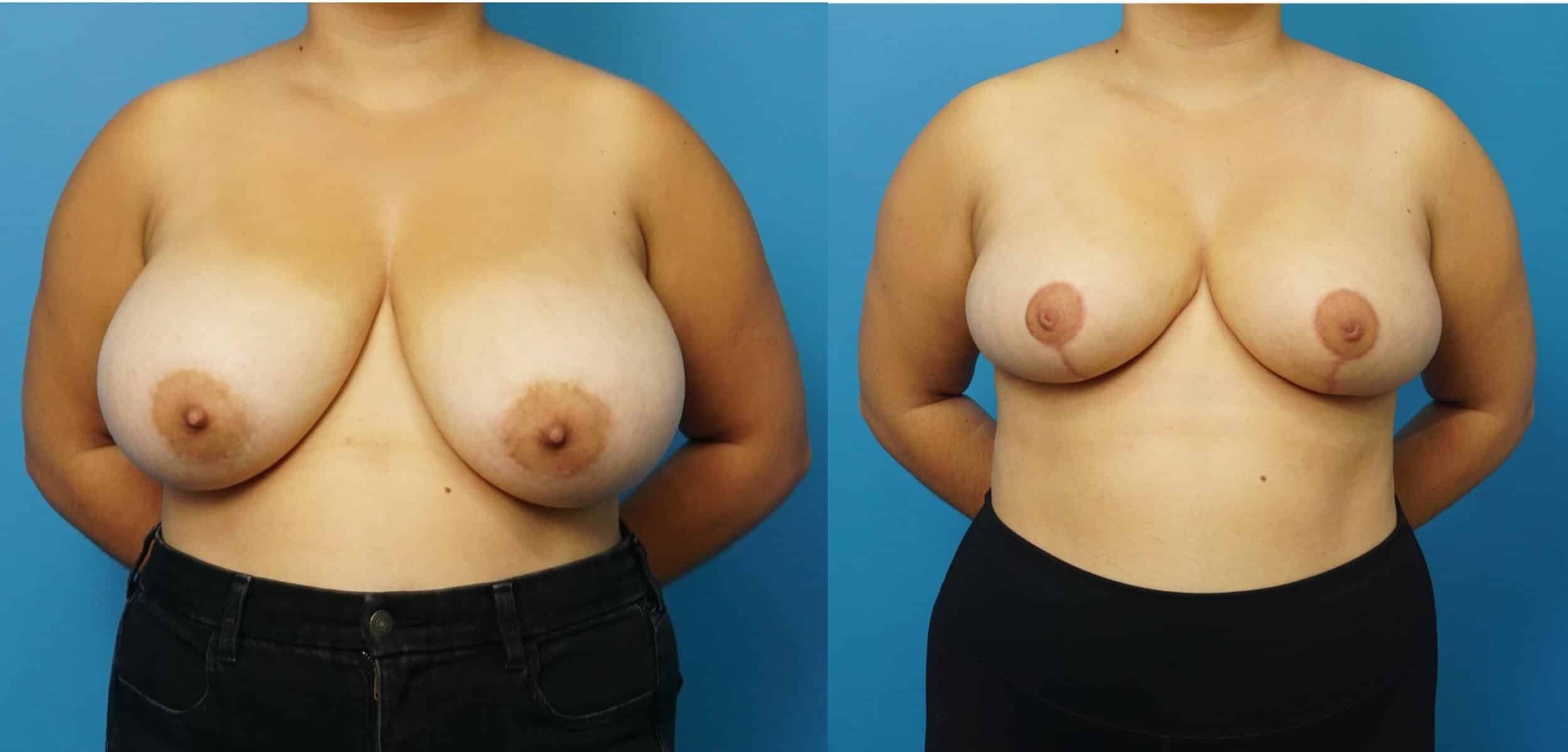 A result from Mark Sisco, MD