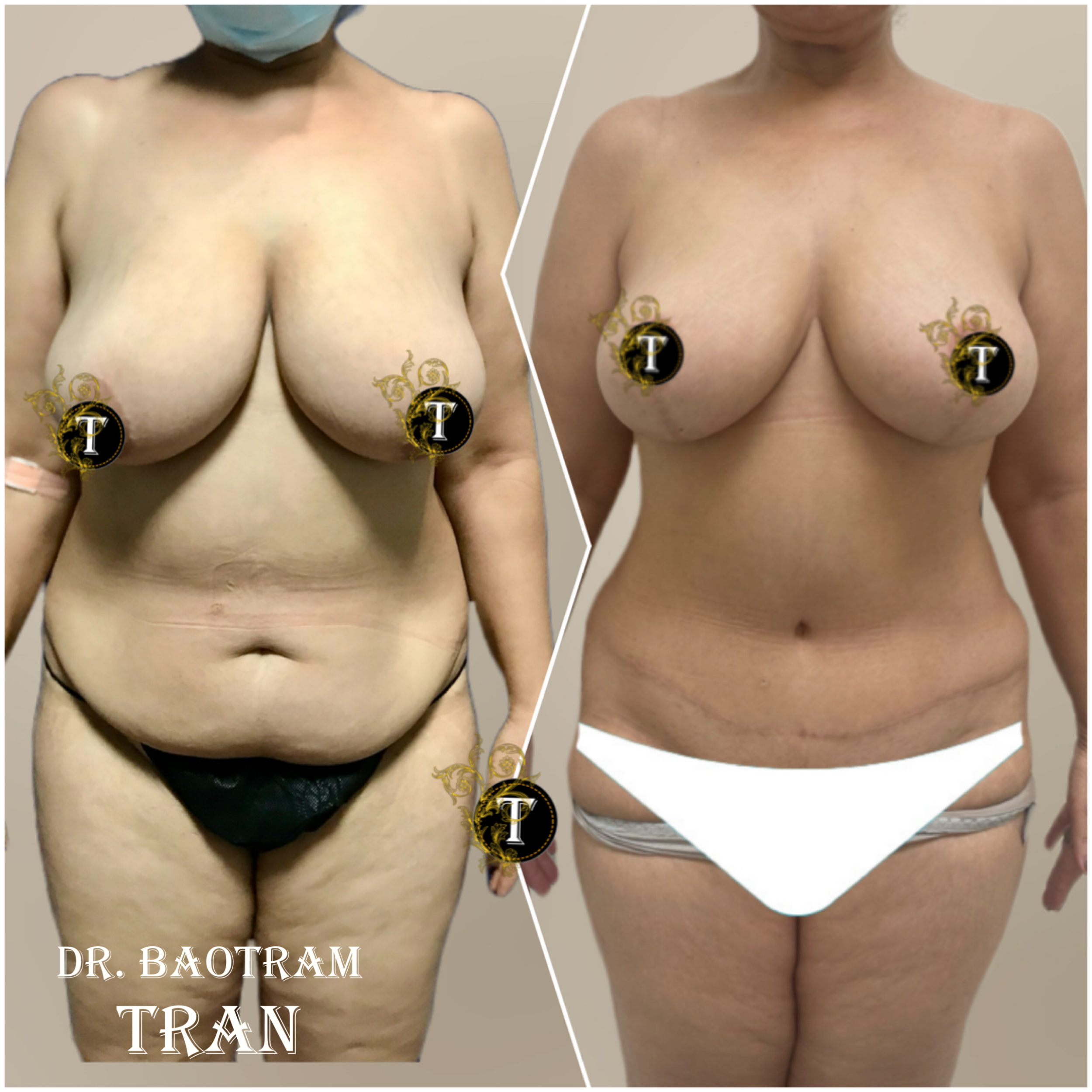 A result from Dr. Tran Cosmetics