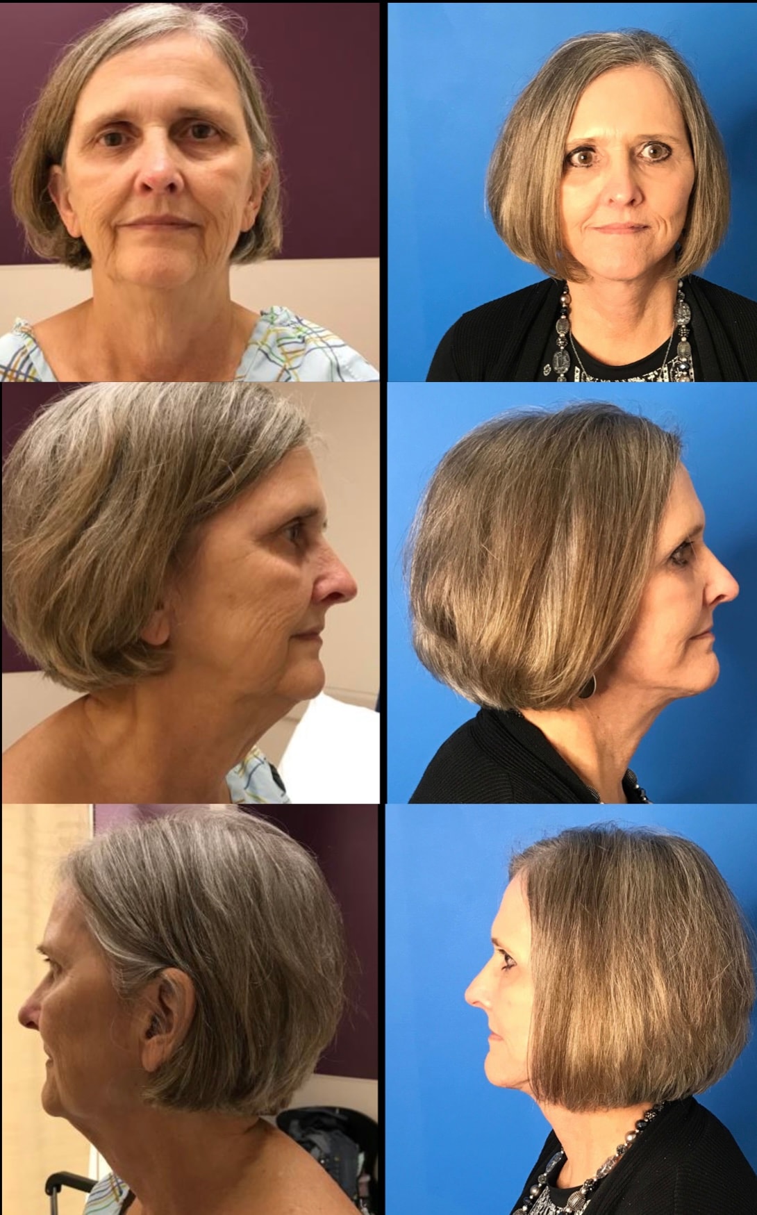 A result from Stanwix Plastic Surgery