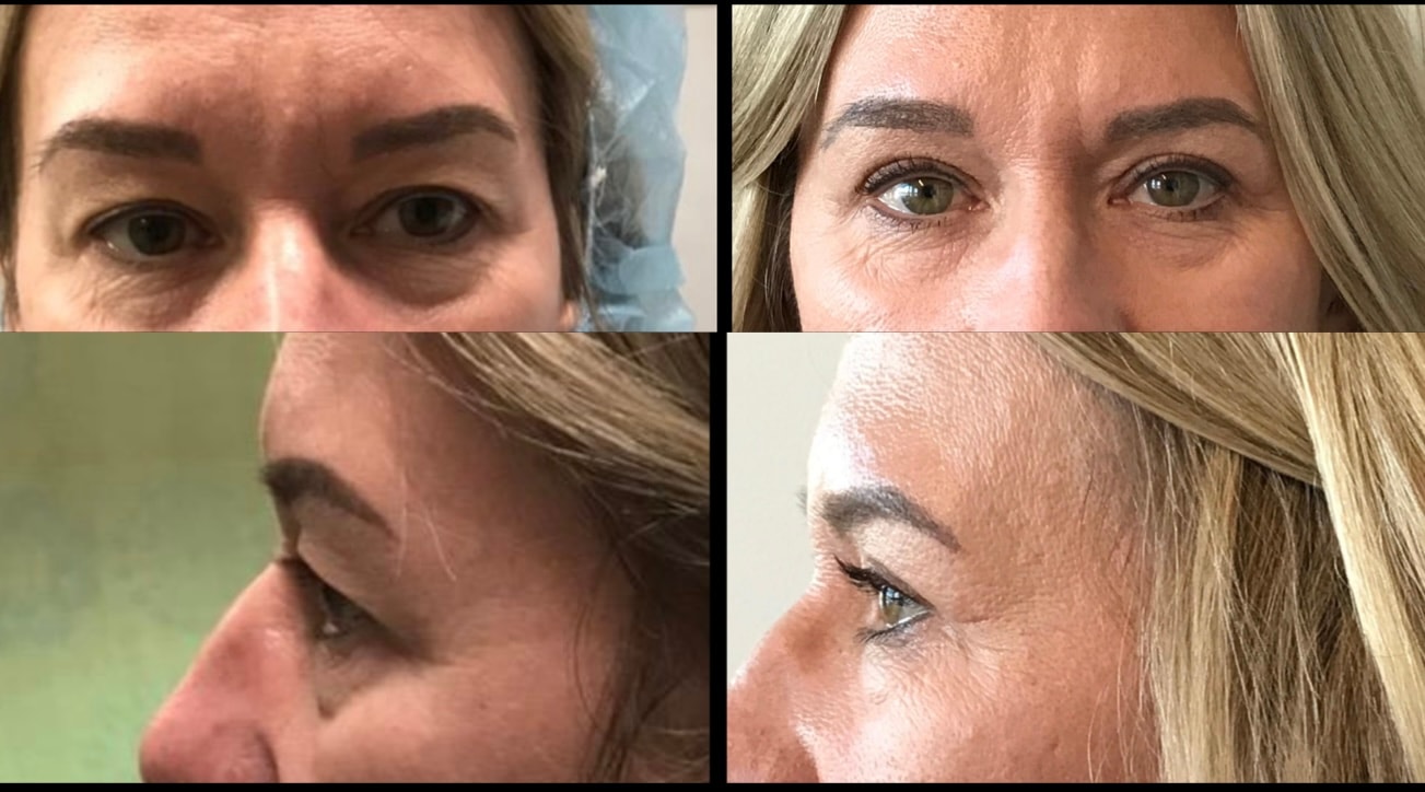 A result from Stanwix Plastic Surgery