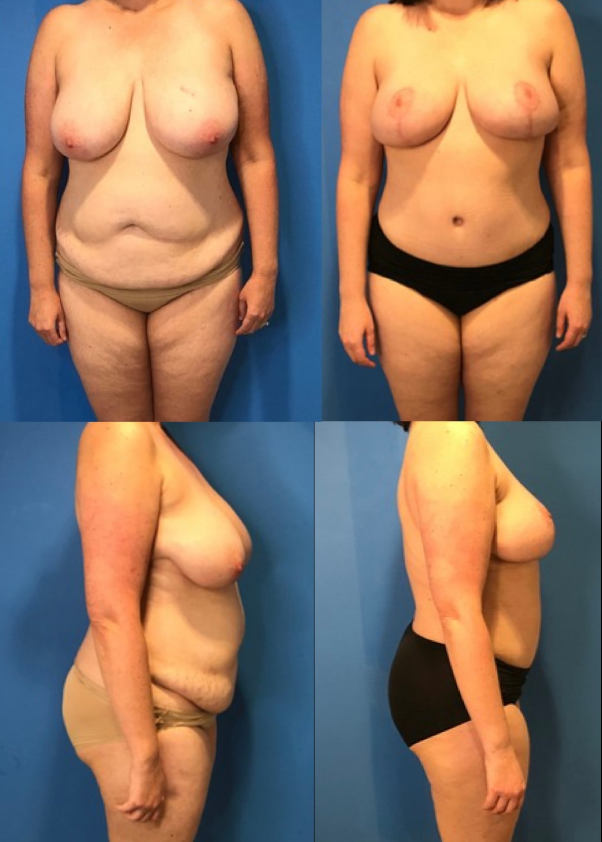 A result from Stanwix Plastic Surgery