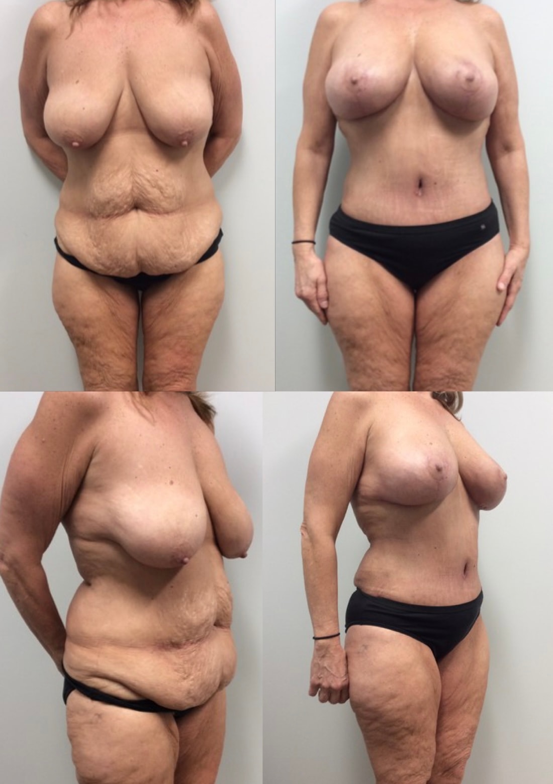 A result from Stanwix Plastic Surgery