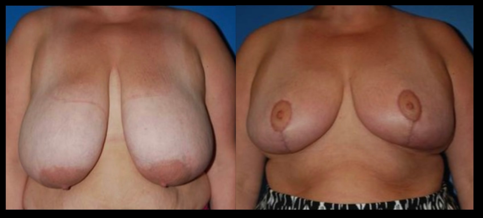 A result from Stanwix Plastic Surgery