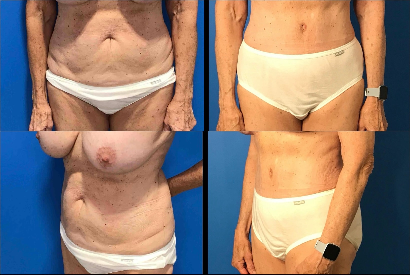 A result from Stanwix Plastic Surgery