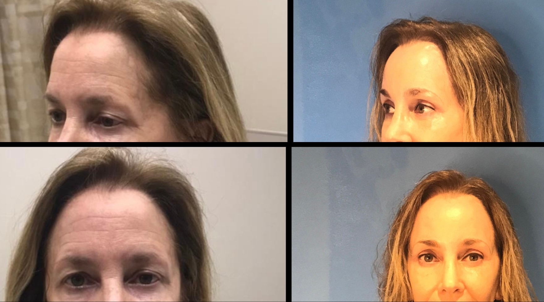 A result from Stanwix Plastic Surgery