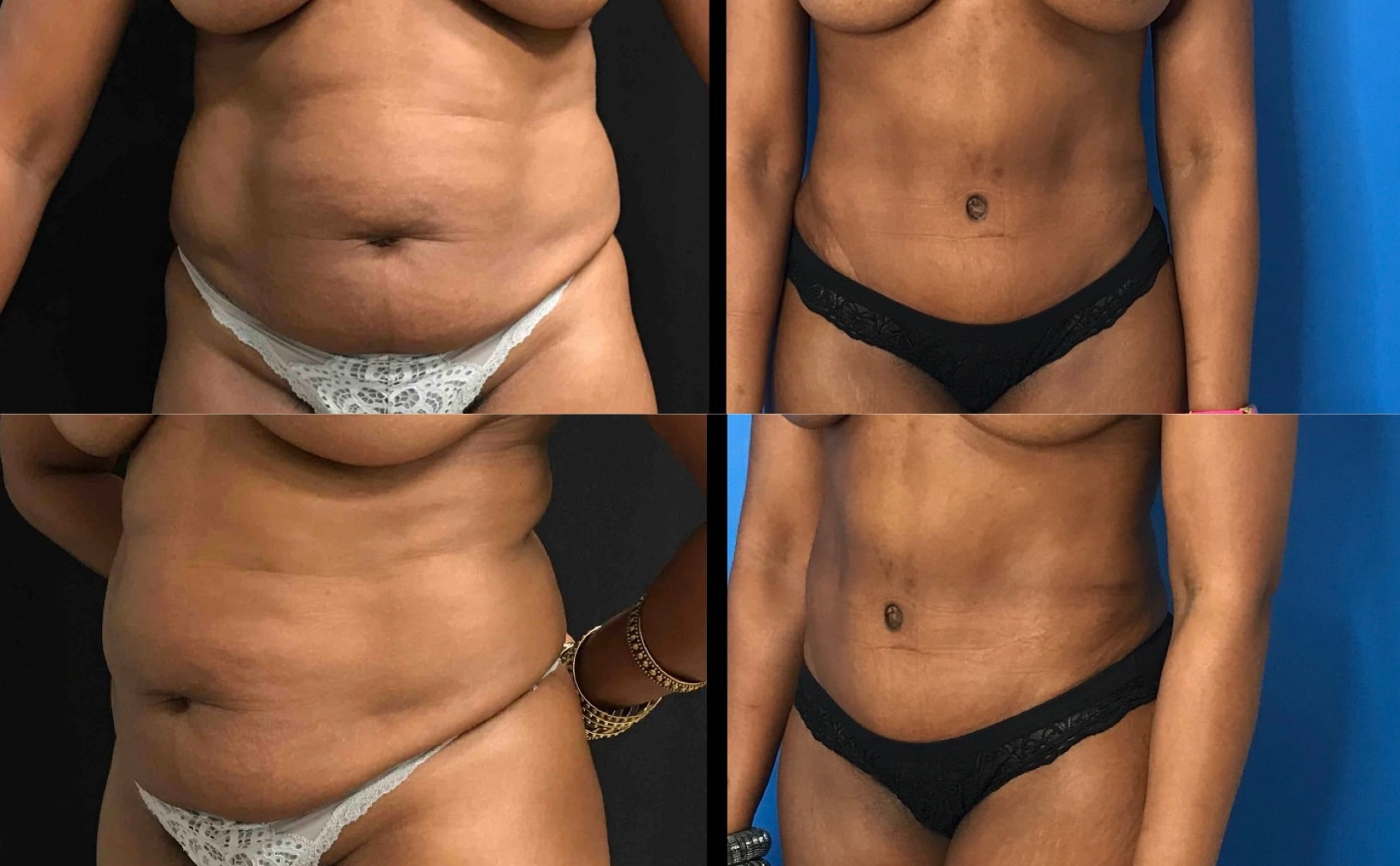 A result from Stanwix Plastic Surgery