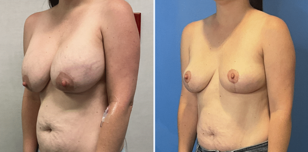 A result from Stanwix Plastic Surgery