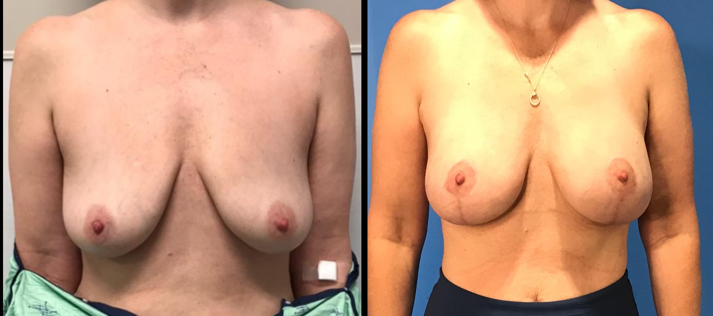 A result from Stanwix Plastic Surgery