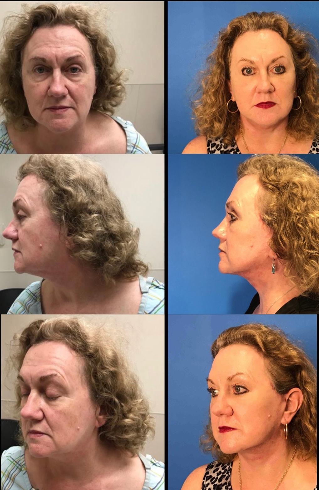 A result from Stanwix Plastic Surgery