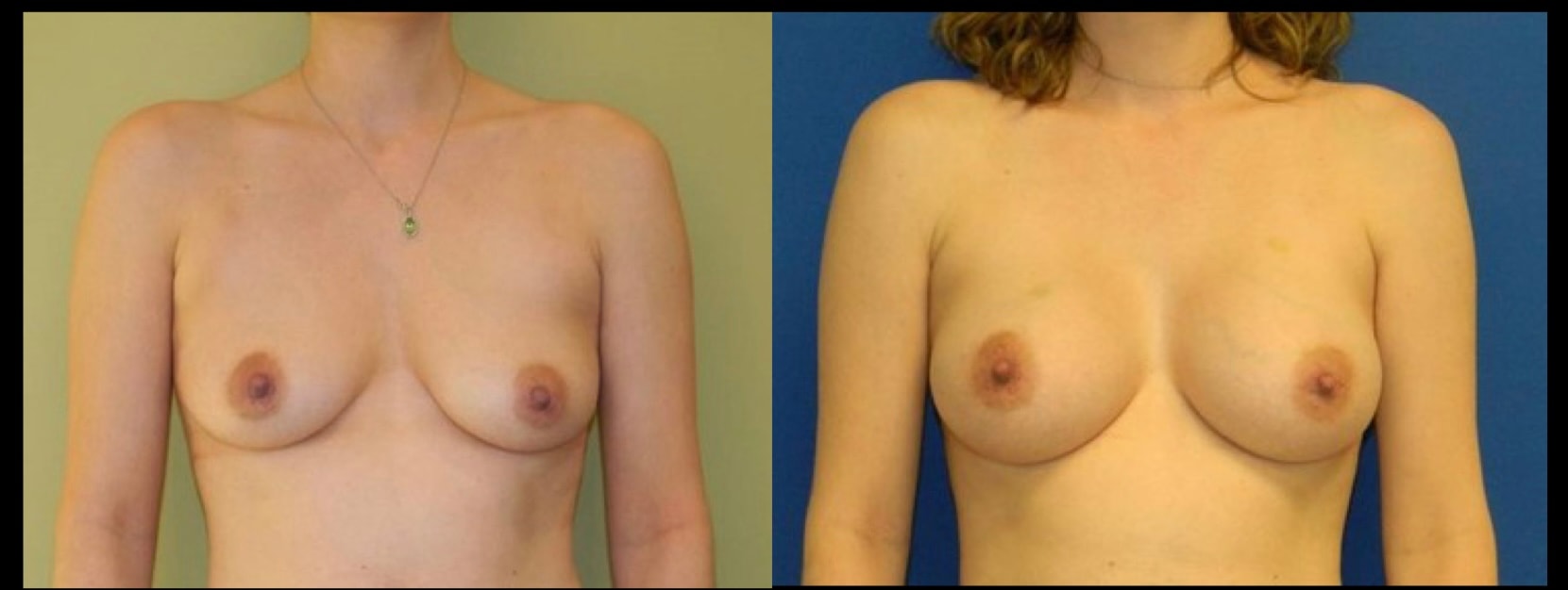 A result from Stanwix Plastic Surgery
