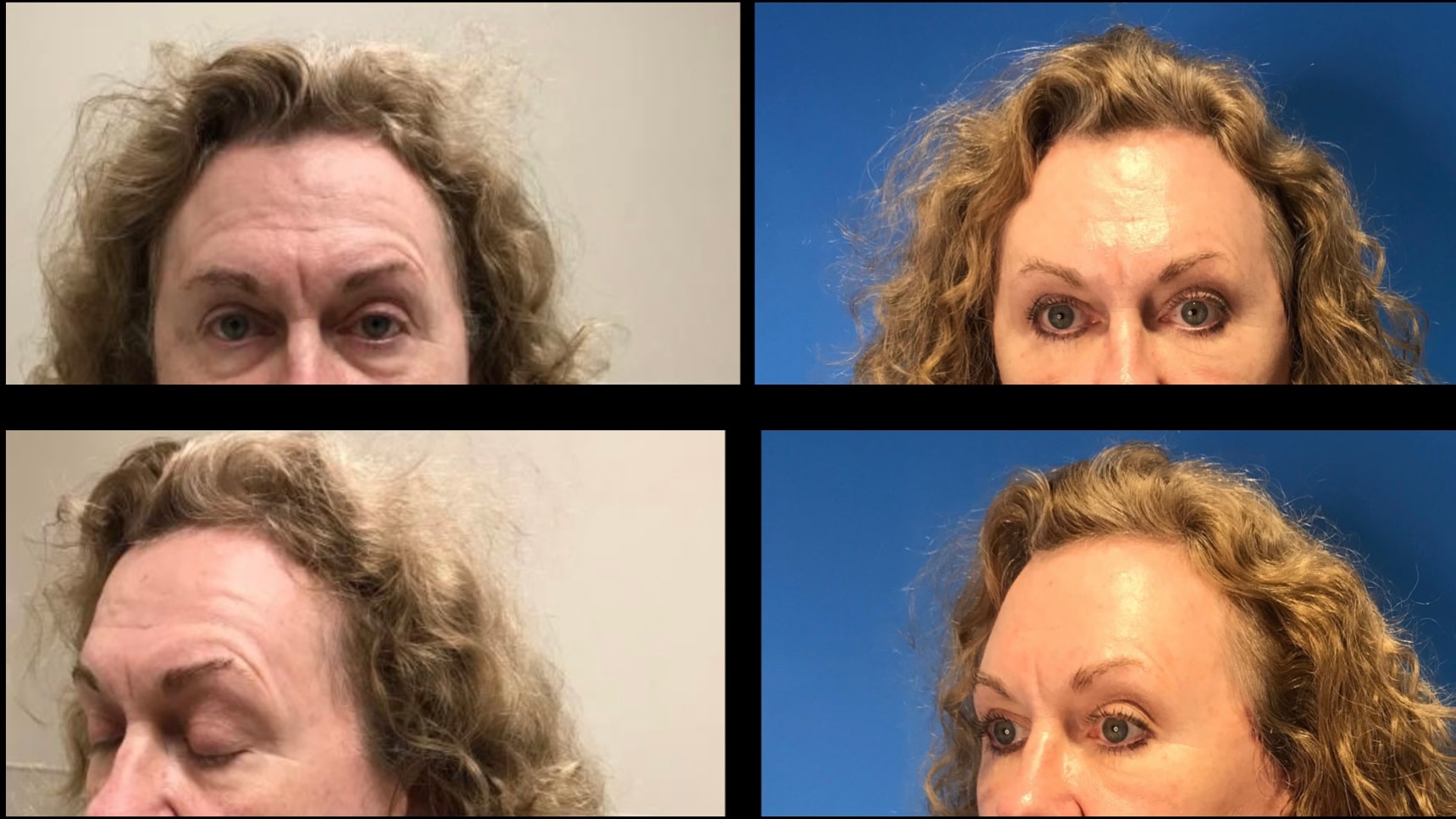 A result from Stanwix Plastic Surgery