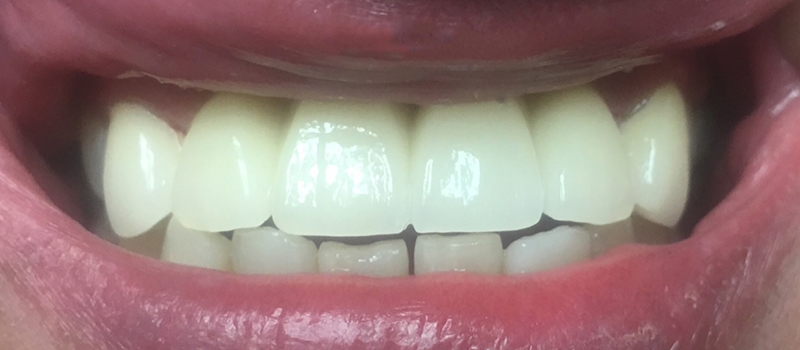 Tru Plano Dental provider photo