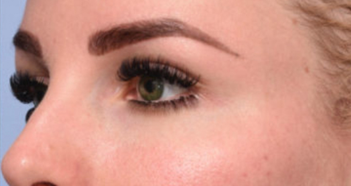 Beverly Hills Aesthetics provider photo