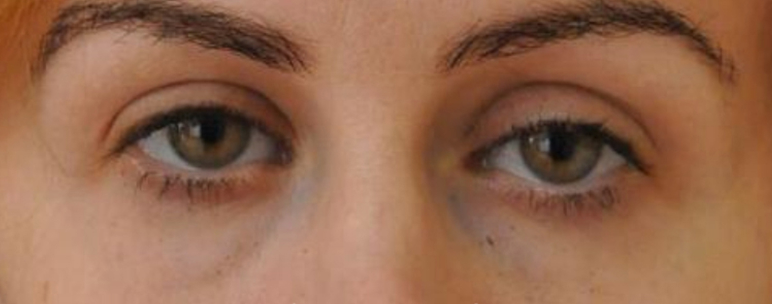 Beverly Hills Aesthetics provider photo
