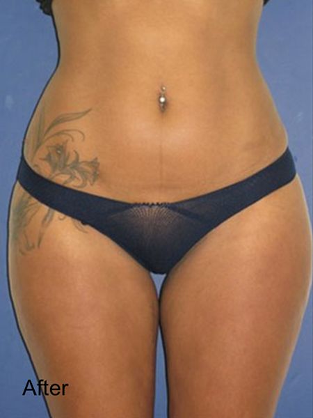 Beverly Hills Aesthetics provider photo