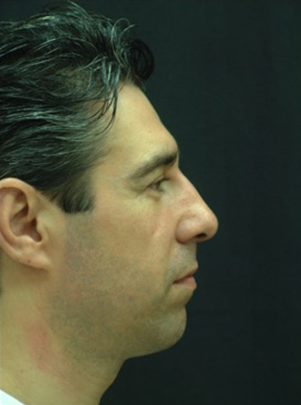 Beverly Hills Aesthetics provider photo