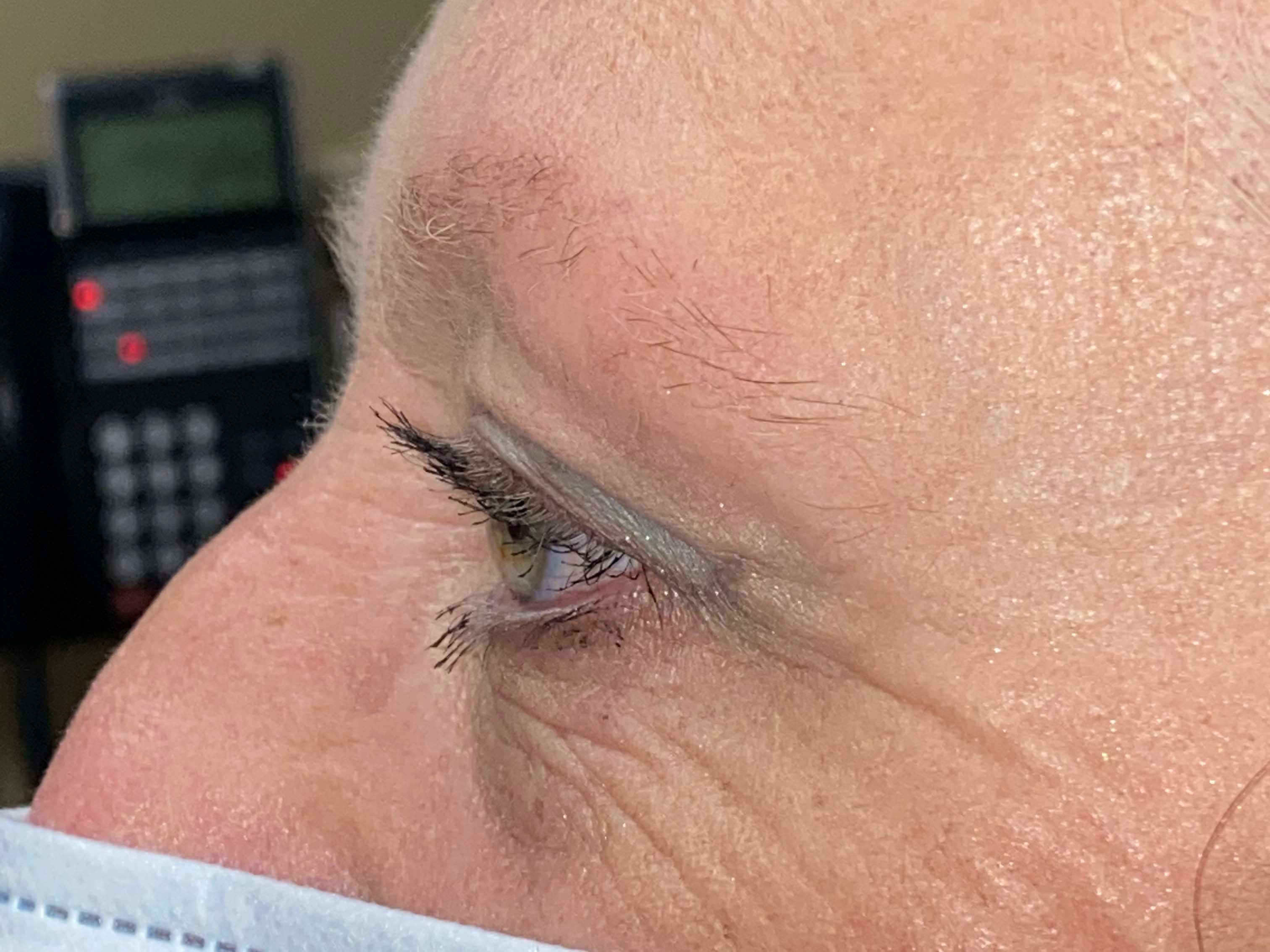 A result from Arkansas Oculoplastic Surgery, PLLC: Brock Wade D MD
