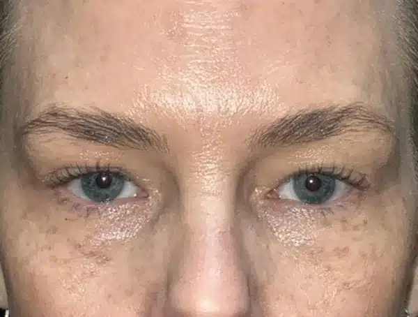 Arkansas Oculoplastic Surgery, PLLC: Brock Wade D MD provider photo