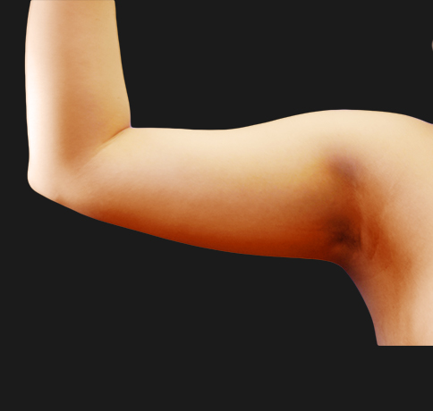 A result from Aristocrat Plastic Surgery: Dr. Kevin Tehrani - NYC