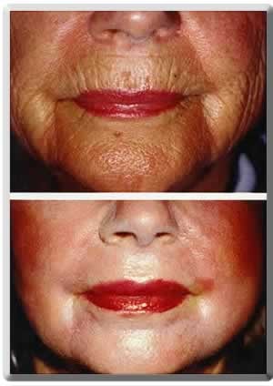 A result from Peter J. Simon, MD