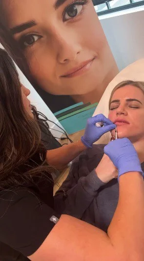 Femme Moderne Center for Aesthetics cheek filler result — Draper, UT