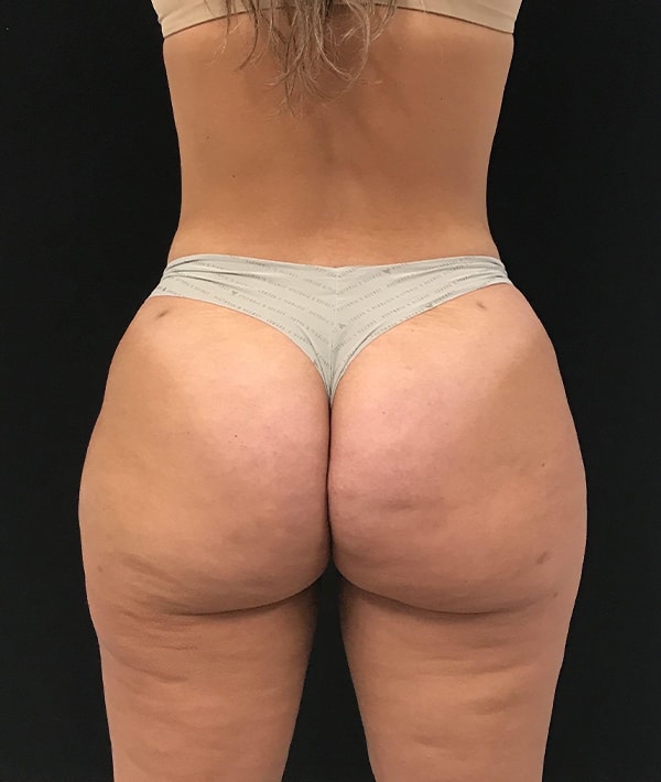 A result from Farkas Plastic Surgery and Medical Spa
