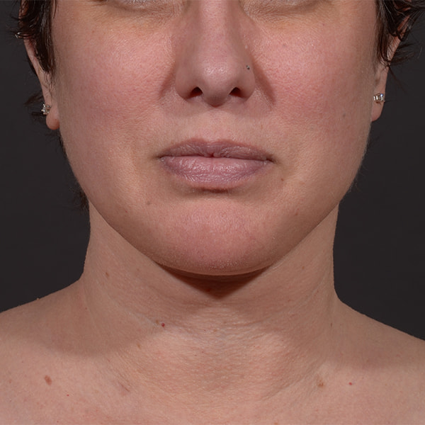 A result from Dr. M.J. Trovato