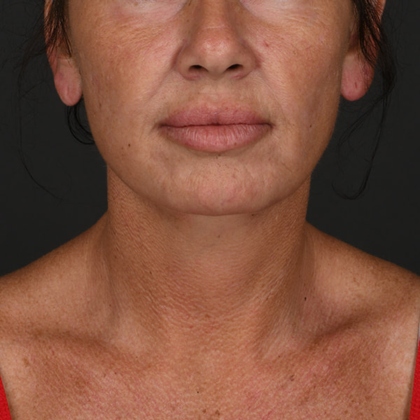 A result from Dr. M.J. Trovato