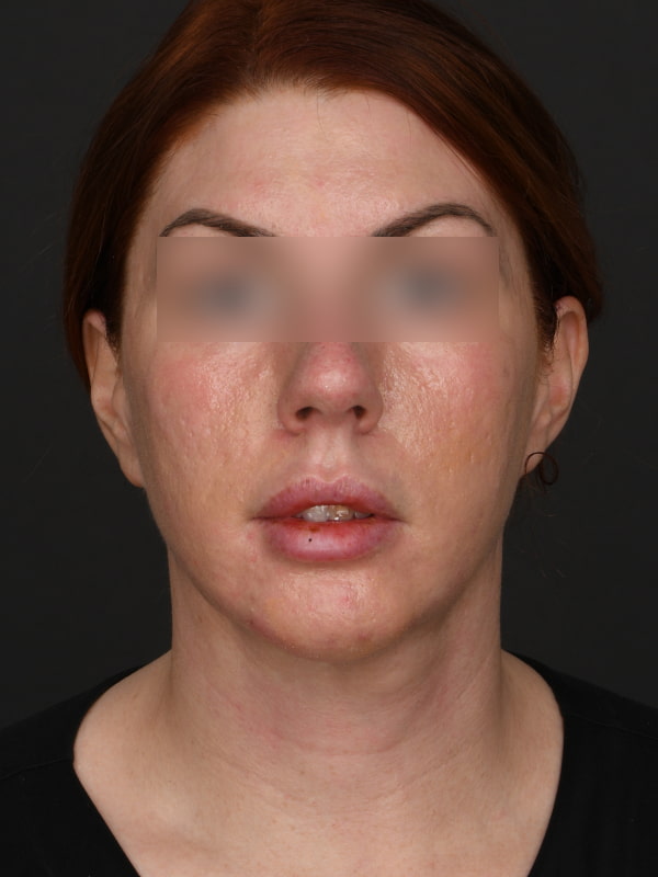 A result from Dr. M.J. Trovato