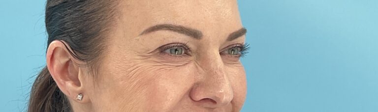 A result from Elysian Wellness & Aesthetics