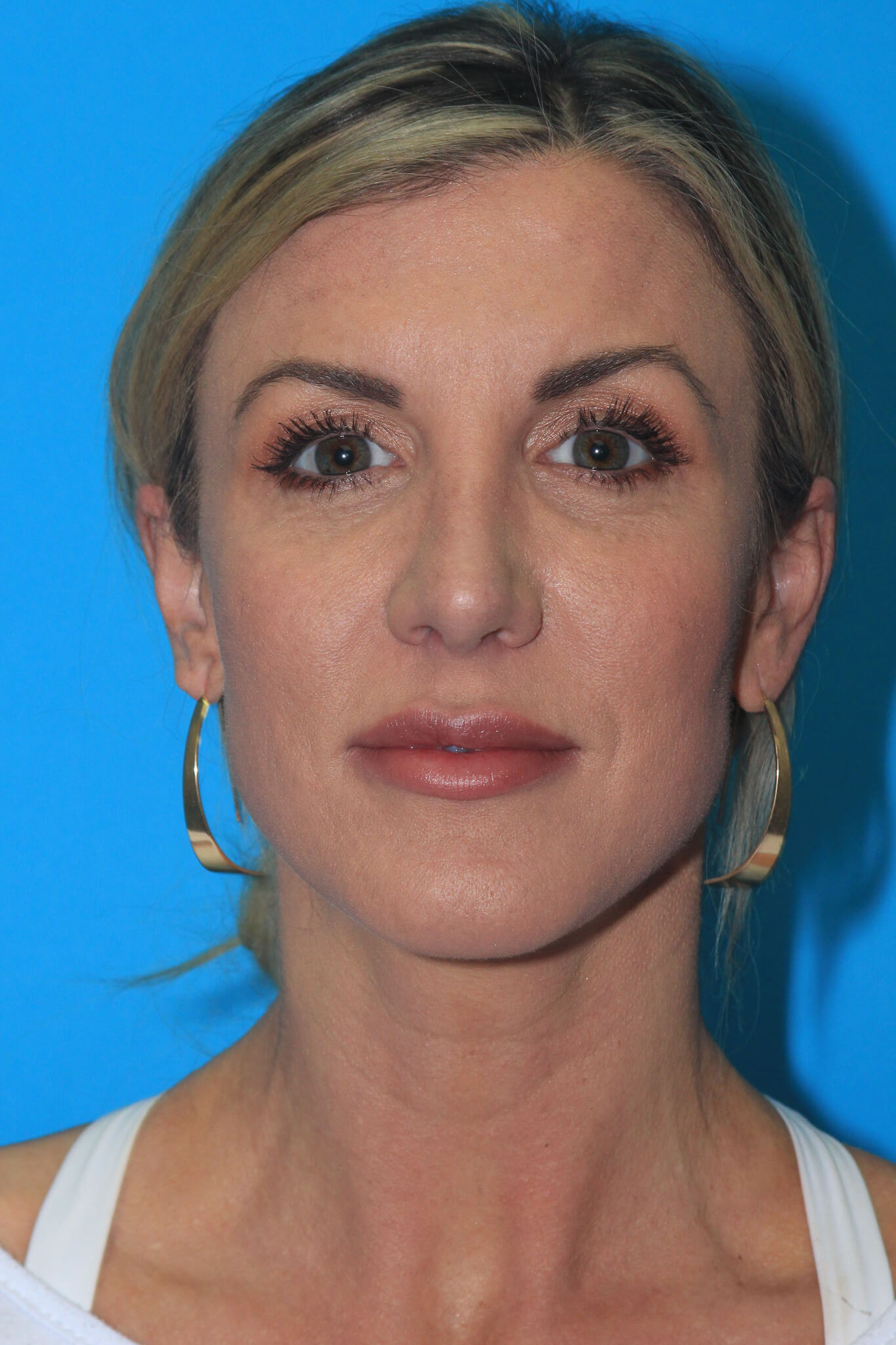 Dr. Andrew M. Wolin: Plastic Surgeon Scottsdale provider photo