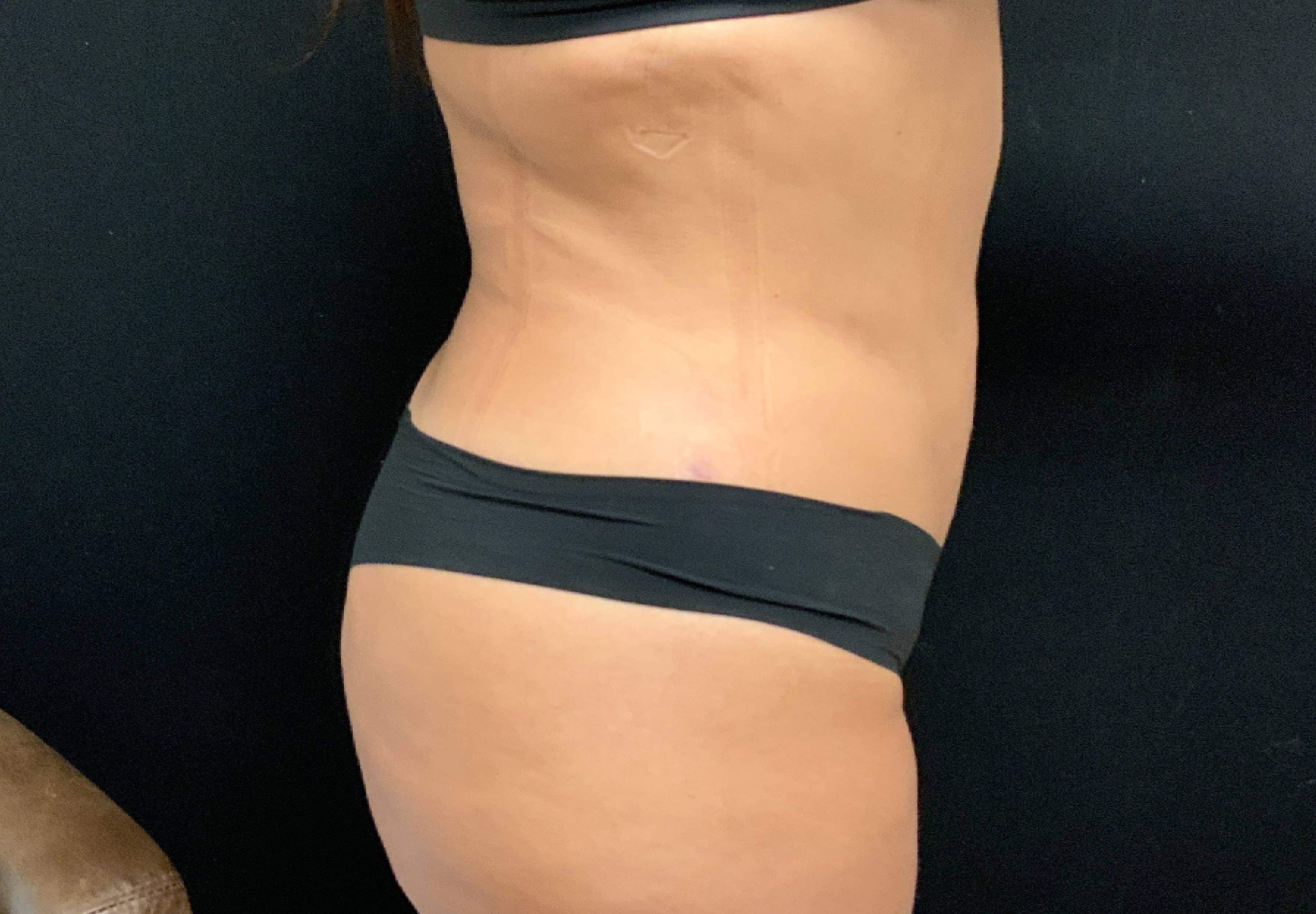 A result from Dr. Hisham M. Seify, MD,PhD