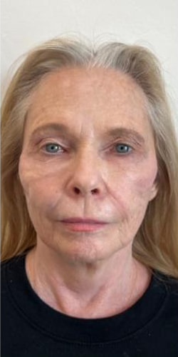 A result from Jewell Aesthetics