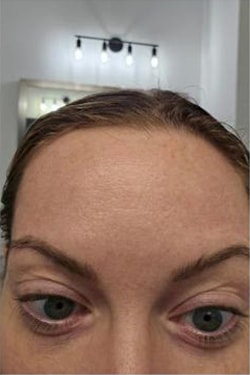 A result from Jewell Aesthetics