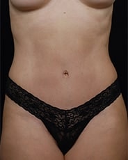 A result from David A. Hidalgo, MD