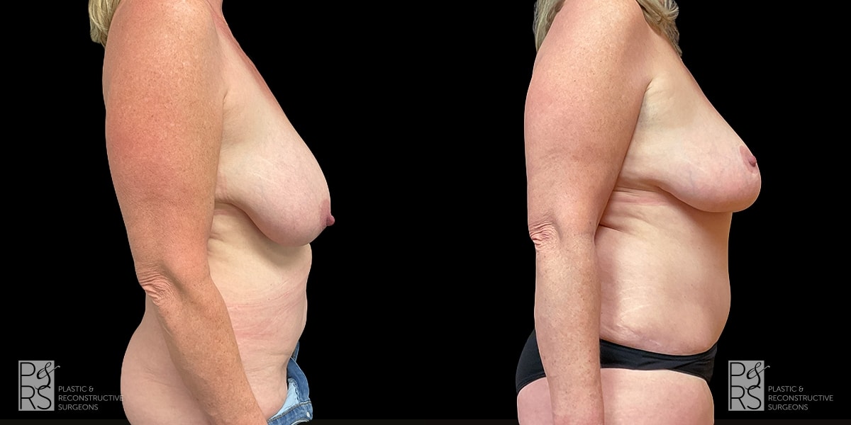A result from Jonathan Hutter, MD