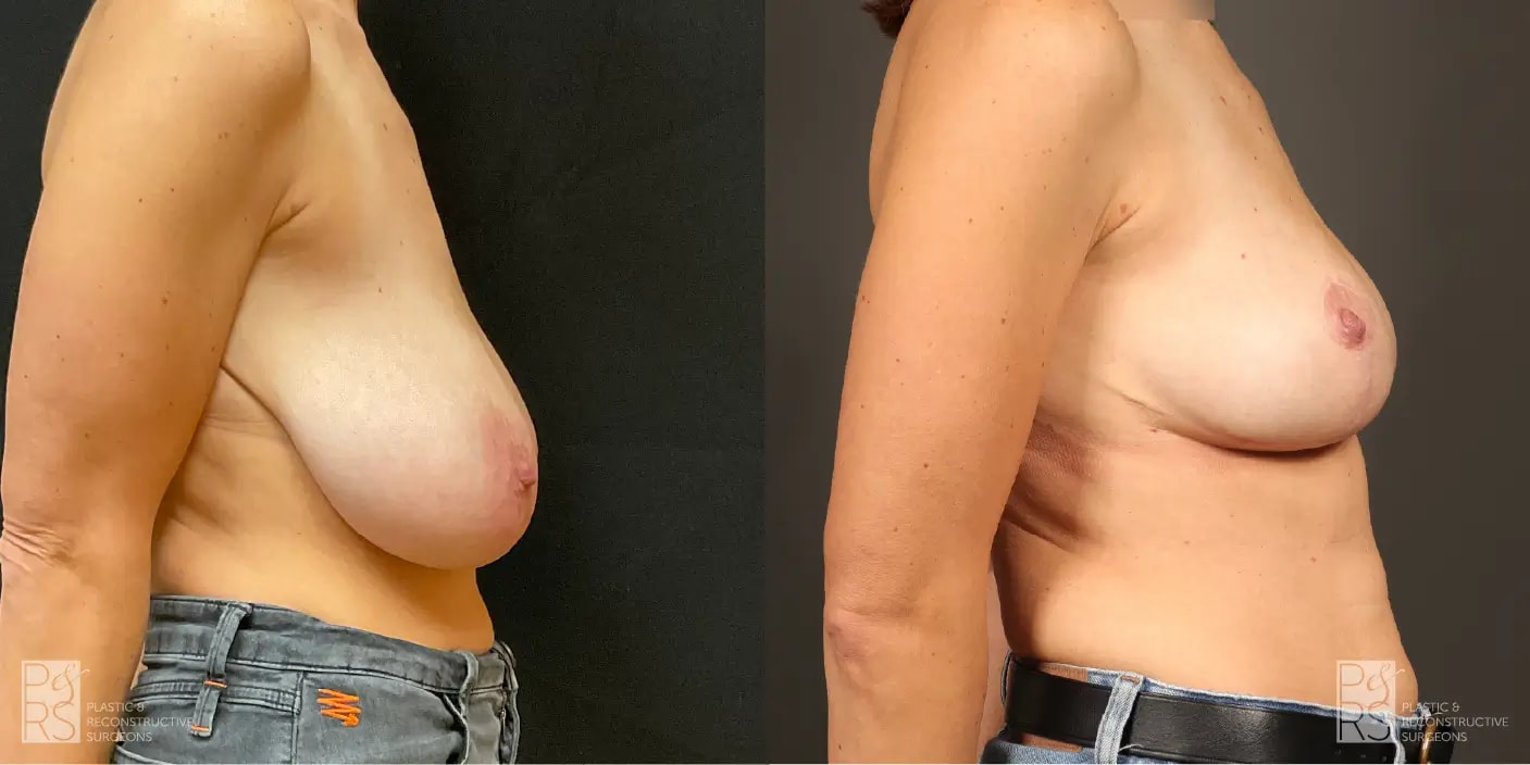 A result from Jonathan Hutter, MD