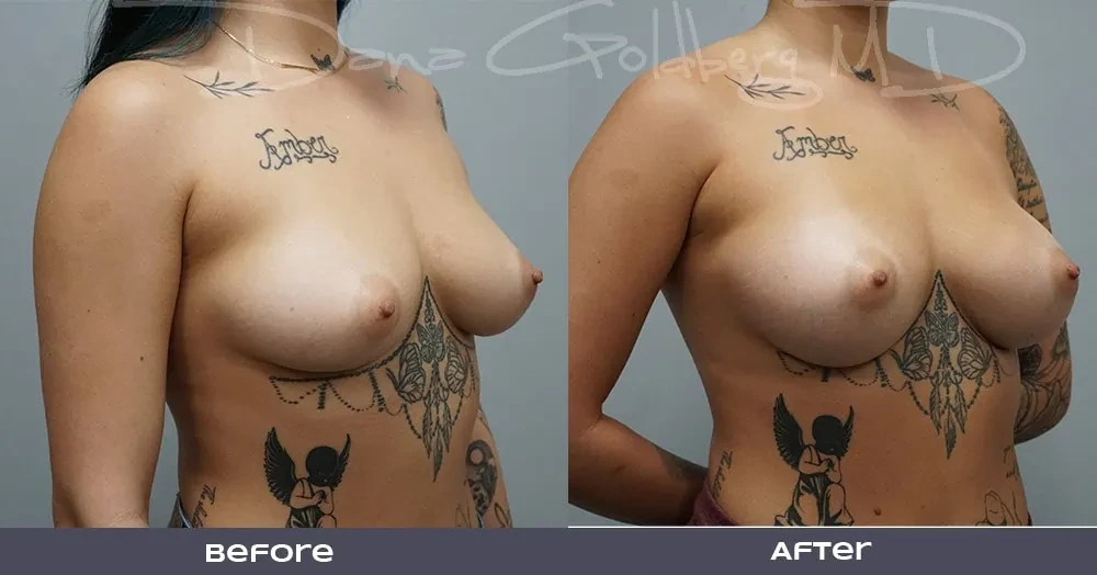 A result from Dana M. Goldberg, MD