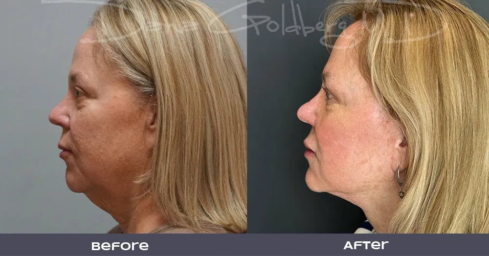 A result from Dana M. Goldberg, MD