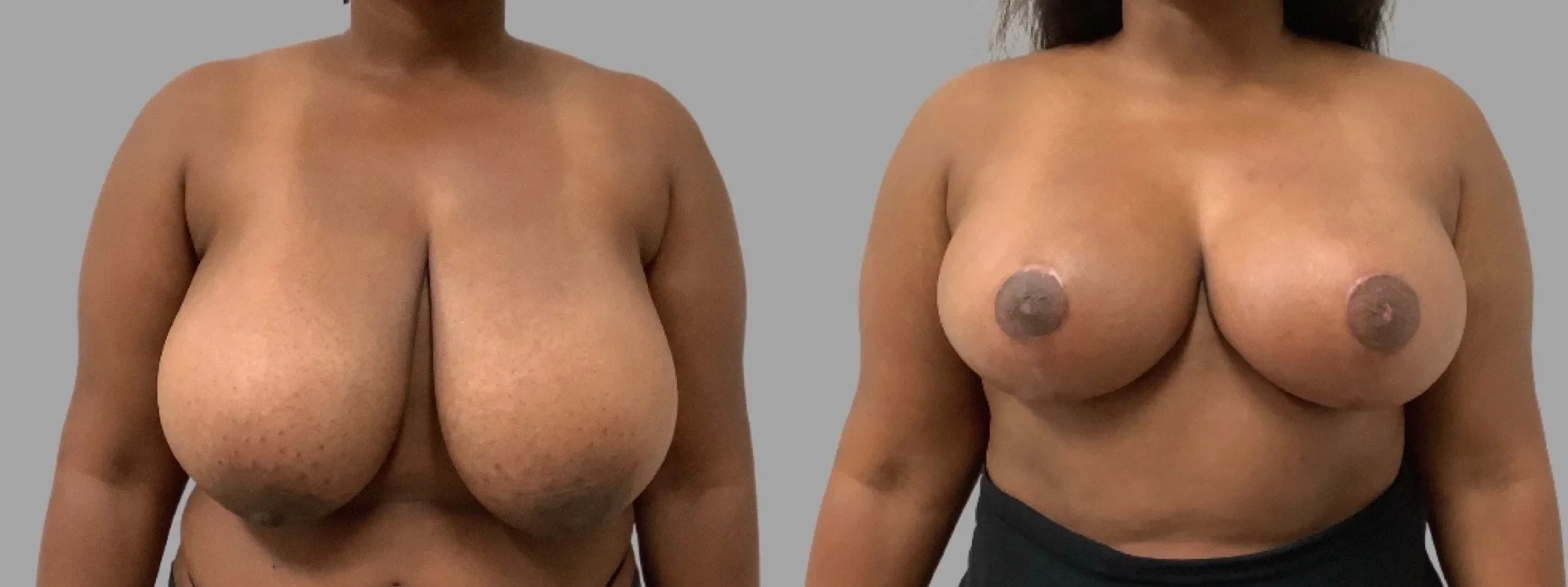 A result from Pavlo Isak, MD