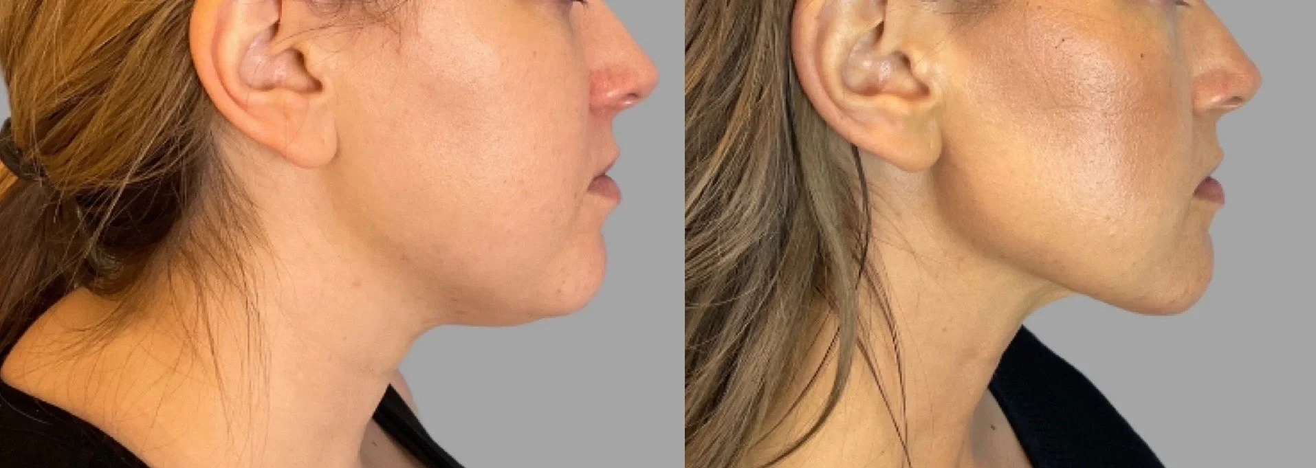 A result from Pavlo Isak, MD