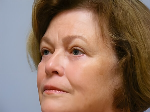 A result from Georgetown Plastic Surgery