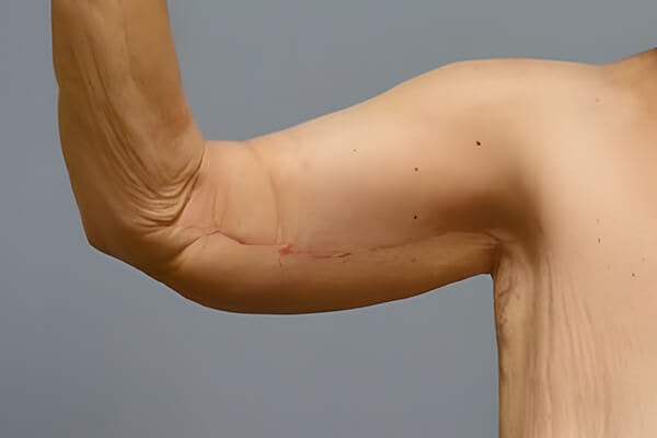 A result from Georgetown Plastic Surgery