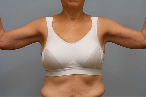 A result from Georgetown Plastic Surgery