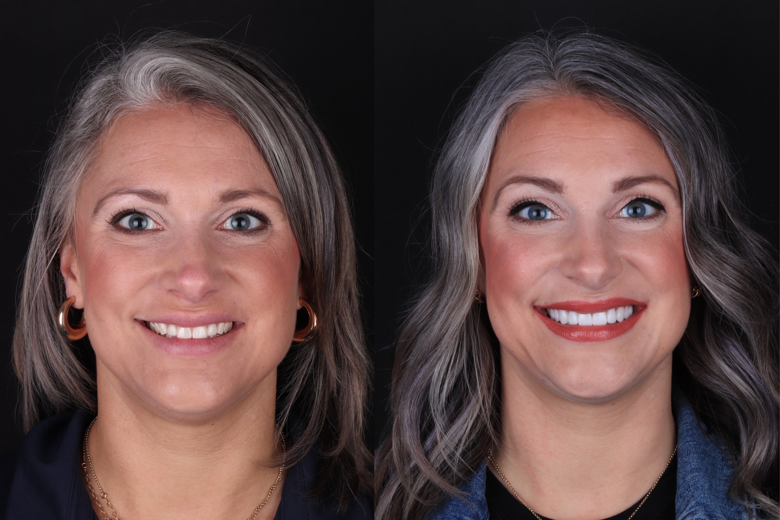A result from The Practice: Dr. Matt Kasiar, DMD | Franklin, TN