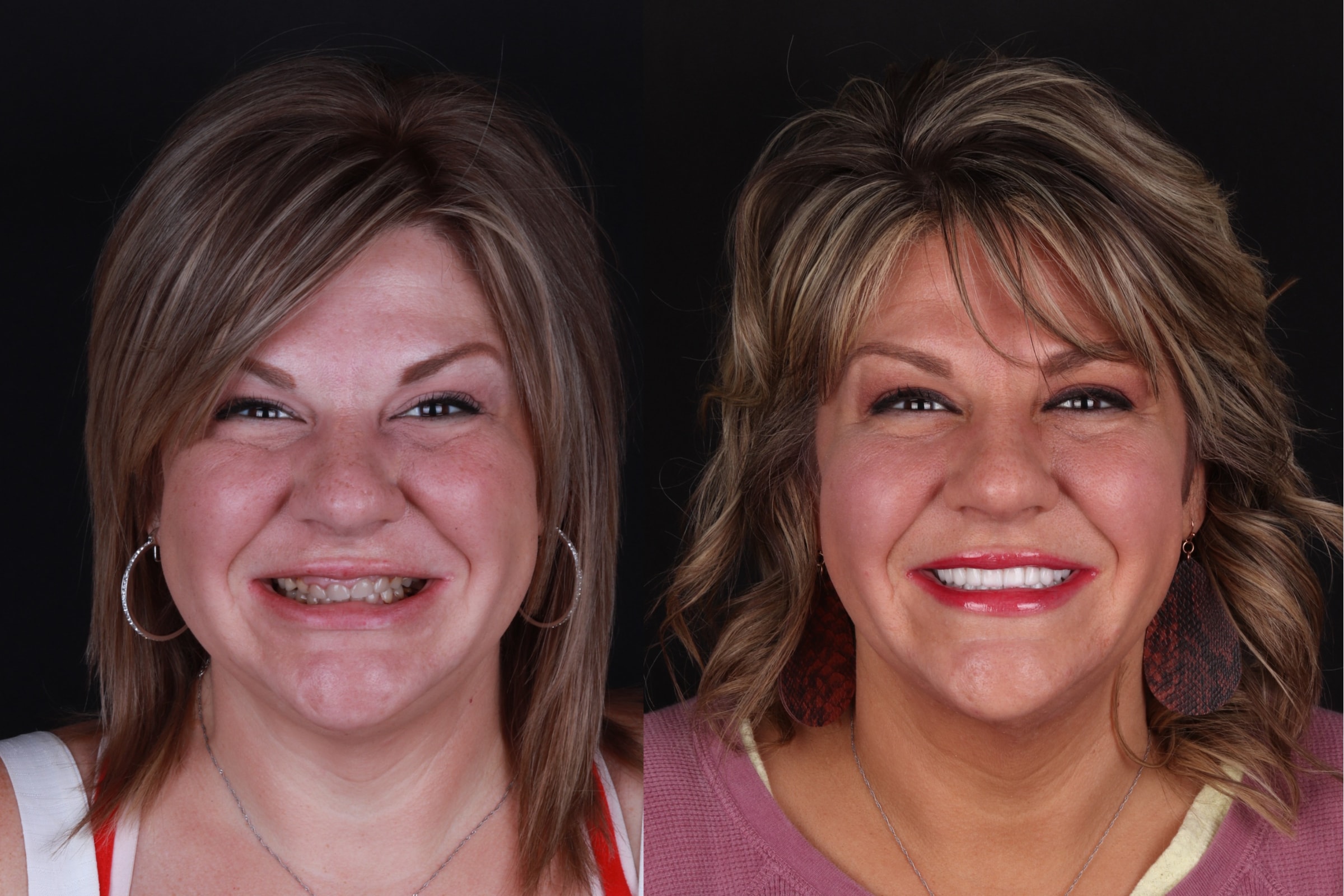 A result from The Practice: Dr. Matt Kasiar, DMD | Franklin, TN