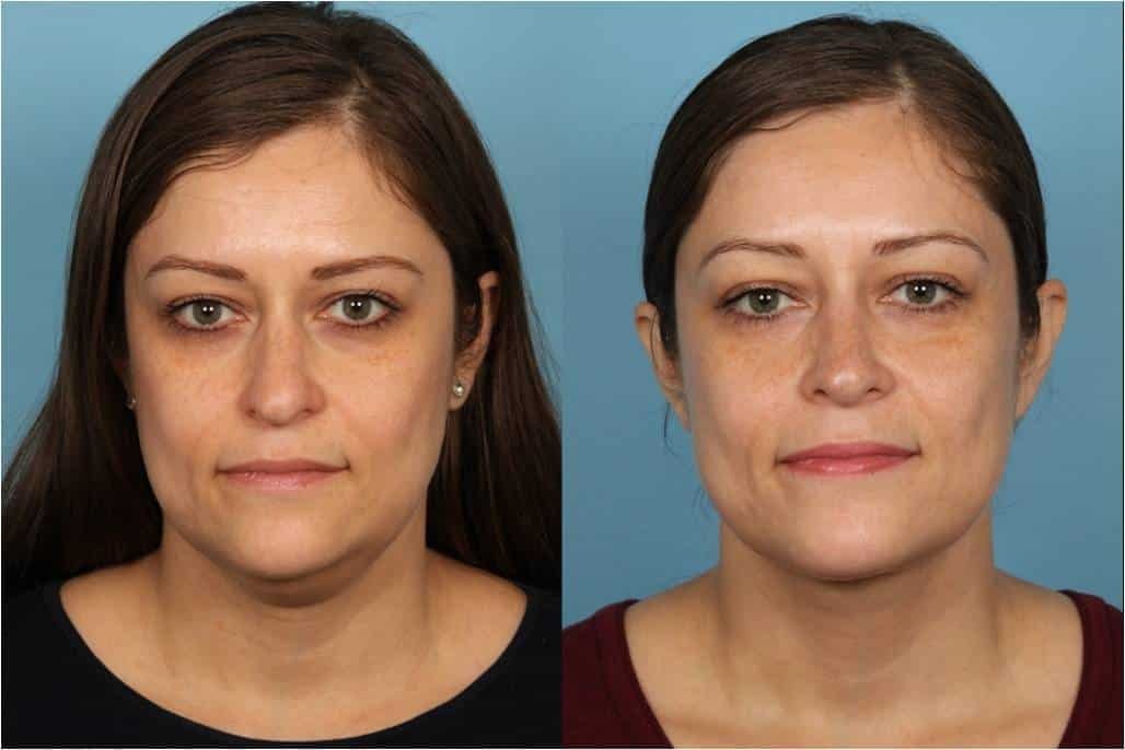A result from Douglas M. Sidle, MD